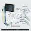 HC-G032A Portable Anaesthesia Laryngoscope with disposable blades/Video laryngoscope set