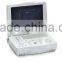 Hospital clinical equipment 15-inch full digital Laptop Ultrasound Scanner China made portable ultrasound machine