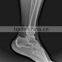 Konida Xray medical dry film compatible with Agfa Drystar and Fuji Drypix