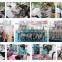 Photon Dialysis Machine for Sale/skin Analyzer Beauty Machine