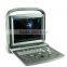 China cheap price USB portable laptop color doppler ultrasound scanner for pregnancy scanner ultrasound