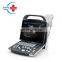 Original Mindray DP-20  ultrasound portable digital ultrasound system with super PW Doppler image