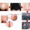 Hot Sell Strawberry Acne Remover Mask Blackhead Reomval Black Mud Nose Mask