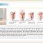 2016 portable 808 diode laser permanent hair removal machine beauty salon spa equipment supplier
