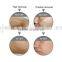 Hot sale !!! IPL machine,portable IPL,E-light IPL hair removal