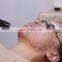 Distributors Wanted Q-switch ND YAG laser tattoo removal  eyebrow removal equipment