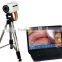 portable digital electronic colposcope with laptop