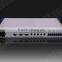 Digital Broadcast Telephone Hybrid