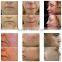 2014 Christmas Promotion!!! 2014 Newest fractional rf/fractional rf microneedle/rf fractional micro needle