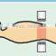 Chinese Physiotherapy Equipment - RF-Capacitive Hyperthermia Machine