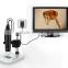 2016 newest HD portable digital microscope1080P 230X connect to any monitor with HDMI-In high resolution microscope
