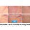 CO2 Laser machine in beauty&Personal Care