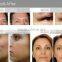 Ultrasonic beauty machine with high frequency OL-3001A for beauty spa