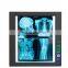 Medical Induction and Adjusting Light Single and Two Brank X-ray Film Viewer
