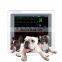 Portable Digital Technology Vet Veterinary Medical animals Vital Sign multiparameter Monitor