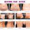 ultra slimming rf slimming beauty slimming body weight loss machine