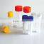 disposable 1.8ml cryovial tube freezing tube