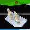 High quality Teaching model for medical 4 stage osteoarthritic knee