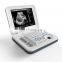 Best Price Scanner Handheld Medical Portable 10.4 Inch LED Laptop Black And White Ultrasound