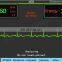 HC-C018 AED BLS Defibrillator ACLS Monitor price with ECG and Spo2