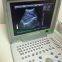 Portable B/W Ultrasound Scanner with Clear Image Quality Hospital Equipment