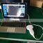Sonostar Laptop PC based high quality medical cheapest portable ultrasound machine for sale UBook-8
