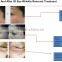 beauty machine eye care system for eye bag removal for wrinkle removal