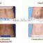 M-C201 2016 Updated slimming machine/portable fat freezing machine/fat freezing machine for home use