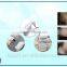 Pigment Removal Lipo Hifu Liposonix Machine Back Tightening For Weight Loss Body Slimming