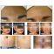 Multifunction 8 in 1 oxygen peeling bio RF face lifting deep cleaning crystal microdermabrasion machine with PDT