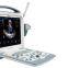 Escaner De Ultrasound Portatil En Color S8I Con 2 Sondas