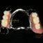 Dental Co-Cr partial denture,Titanium framework denture, dental dentures, laboratoire dentaire, Dentallabor, laboratorio dental, dental laboratory, Shenzhen LJ dental lab China