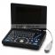 10.4 inch LCD Laptop Ultrasound machine PC system 3.5Mhz Convex probe 7.5MHz linear probe portable ultrasound scanner price