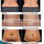 2017 Advanced Beijing Sincoheren Cellulite Freezing Cool Shaping Machine for Weight Loss
