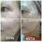 Multifunction SHR+Elight+IPL opt ipl  hair removal machine Hair Removal dark circle wrinkle remove tattoo OPT Beauty machine