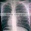 fuji x-ray film agfa x-ray film medical film scanner film digitizer x-ray films knd