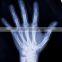 Konida Xray medical dry film compatible with Agfa Drystar and Fuji Drypix