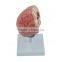 Organs Human Body Anatomy Brain Model Of Stroke