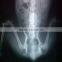 fuji x-ray film agfa x-ray film medical film scanner film digitizer x-ray films knd
