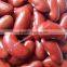 New Crop Red Kidney Beans Heilongjiang Origin