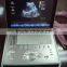 MC-DU-C5 Laptop Color Doppler Ultrasound System SonoScape 4d ultrasound promotion product