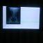 Ultra Slim LED Hospital X-ray Film Viewer Double Section