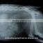 Coupon available! MSLMF02 Best seller green sensitive x ray film with CE for sale