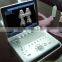 Sonostar hospital veterinary equipment B model ultrasound machine for sale V9