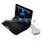 Mini Laptop CE Approved Cheap Price Pregnant Diagnosis Ultrasound Scanner Machine with Probe/Transducer-RUS-9000F