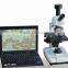 MDI Detector Microscope Sub-health Analyzer With One Drop Of Blood