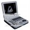 XF-30A Notebook full digital ultrasound scanner