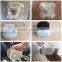 2016 Hot Sale Hifu Nasolabial Folds Removal Machine Uf576 Back Tightening