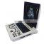 High quality full digital black and white ultrasound diagnostic system for examination
