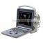 Portable Ultrasound Color Doppler with Competitive Price K6